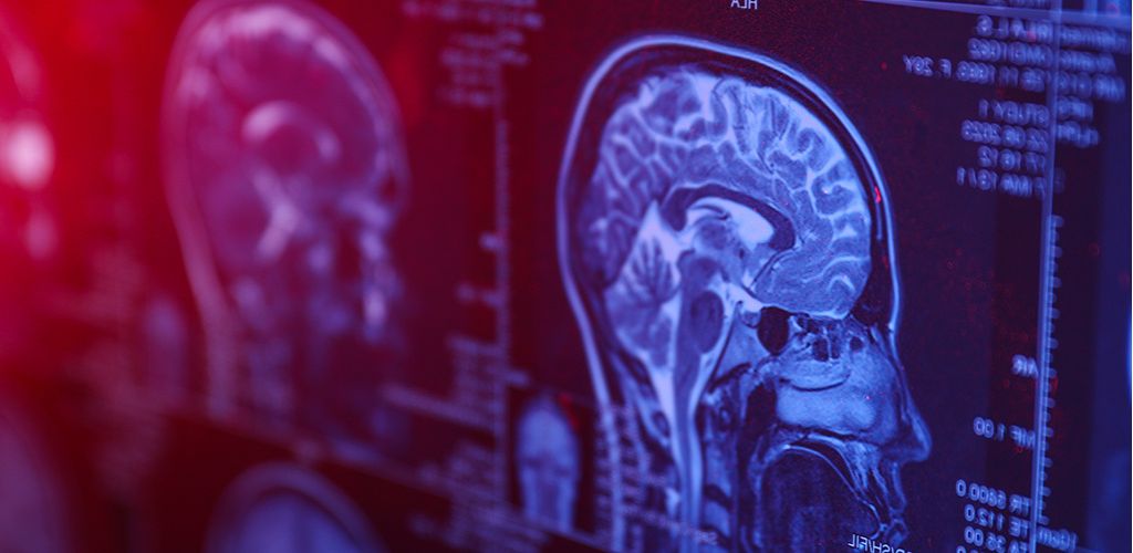 Nootrópicos legales en España - Aldous - ES